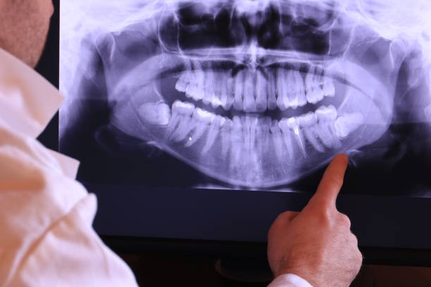 Best Emergency Dentist for Lost Fillings or Crowns in Frankfort, IL