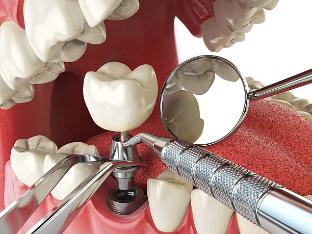 Best Emergency Dentist for Special Needs Patients in Frankfort, IL